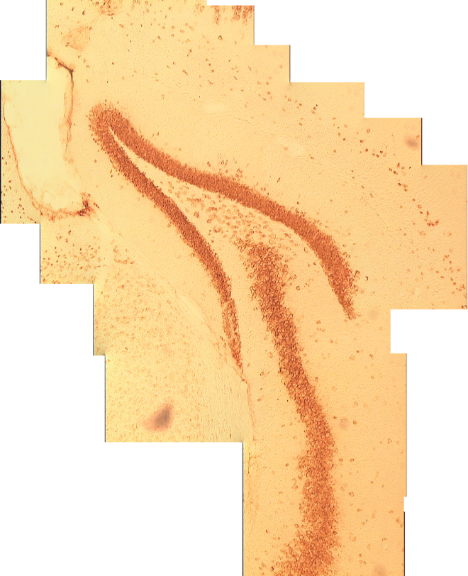 Dentate granule cells in the dentate gyrus of the mouse stained using NeuN antibody