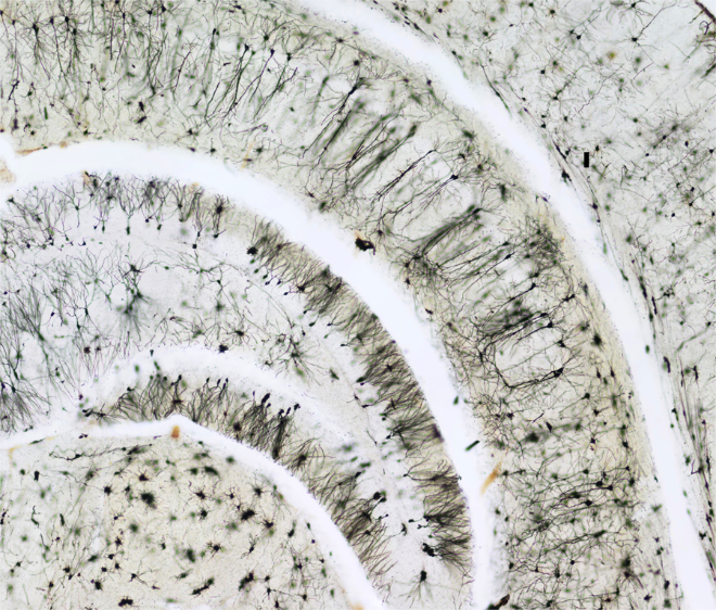 The hippocampal structure in the Ts65Dn mouse model of Down syndrome.